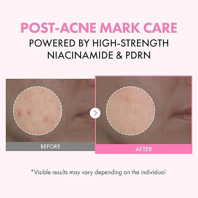 TOSOWOONG Pink PDRN Niacinamide Milky Toner – 150 ml